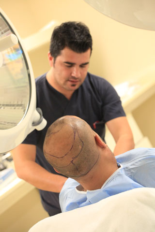 FUE hair transplantation